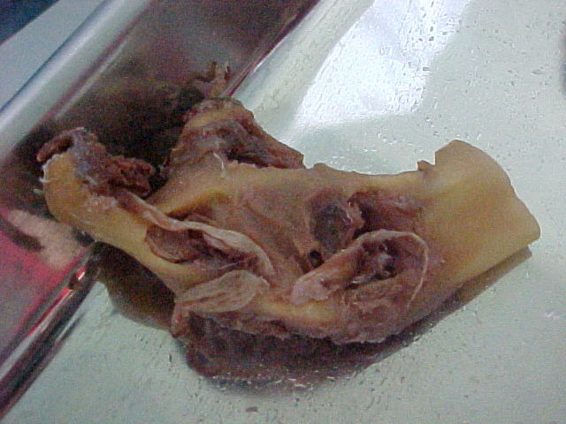 First macroscopic view of the resected mandibular specimen supplied with the historical case